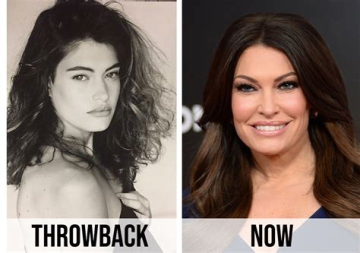 Exploring The Allure Of Kim Guilfoyle's Lips