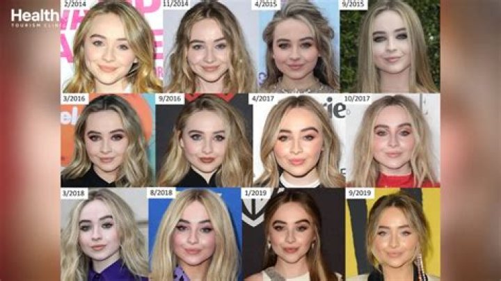 Exploring The Transformation: Sabrina Carpenter's Journey With Plastic Surgery