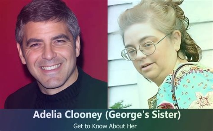 George Clooney's Sister: A Journey Of Love And Resilience With Down Syndrome