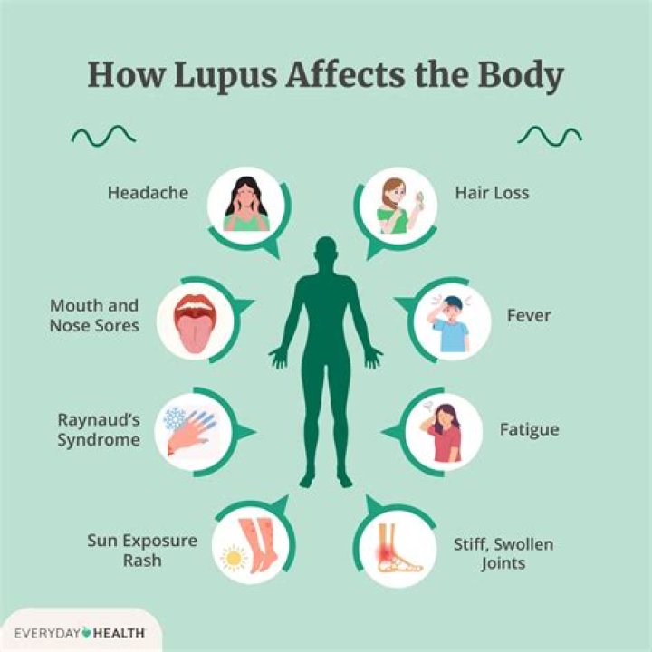 Lupus And Ozempic: Understanding The Connection