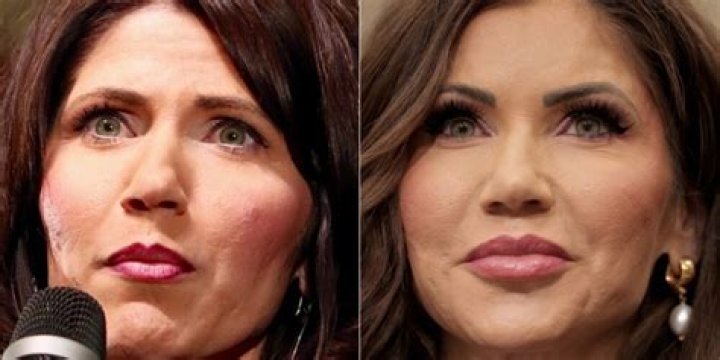 Transformation Chronicles: Kristi Noem Before And After Cosmetic Surgery