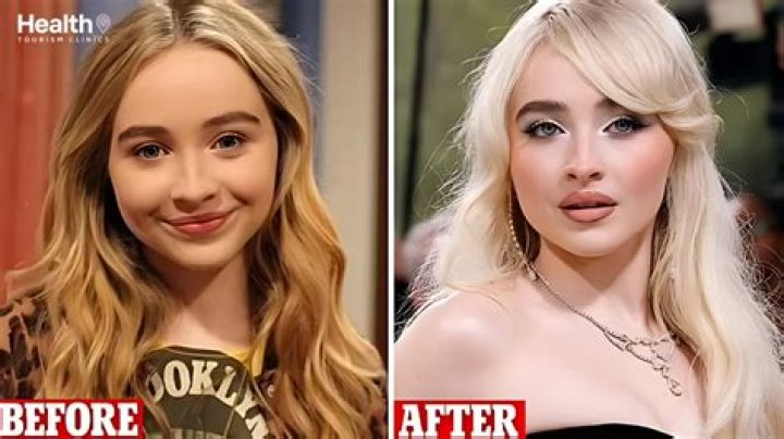 Transformative Journey: Before And After Sabrina Carpenter