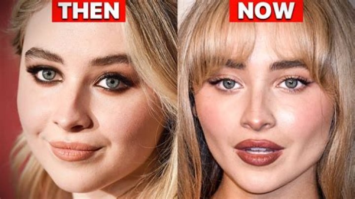 Unraveling The Mystery: Does Sabrina Carpenter Have Lip Fillers?
