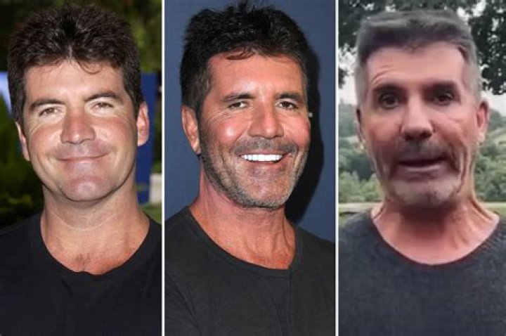 Unraveling The Truth: Is There Anything Wrong With Simon Cowell's Son?