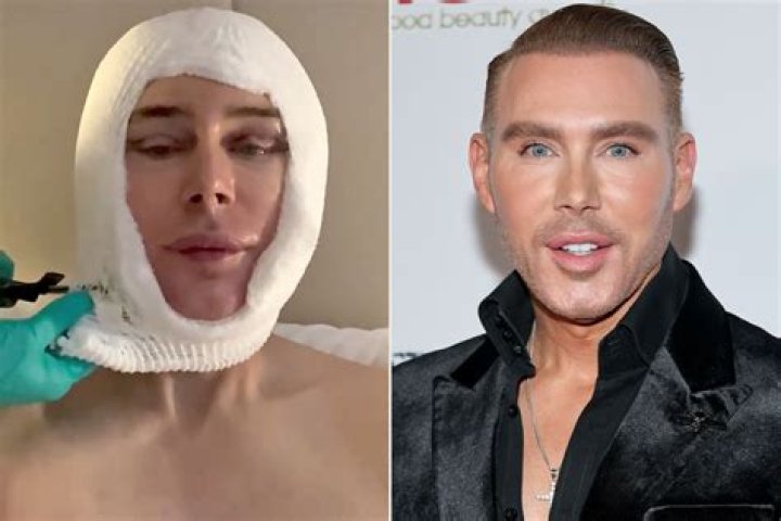 Unveiling The Truth: Anthony Kiedis And His Plastic Surgery Journey