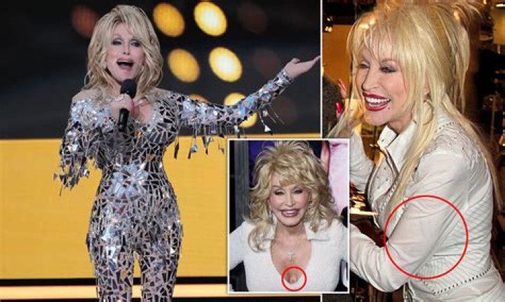Unveiling The Truth: Are Dolly Parton’s Boobs Fake?