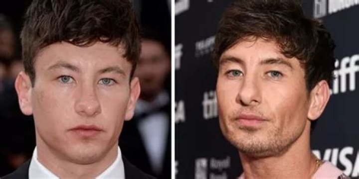Unveiling The Truth Behind Barry Keoghan's Plastic Surgery Rumors