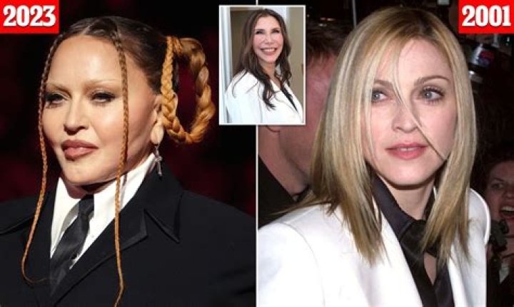 Unveiling The Truth Behind Maura Tierney's Plastic Surgery Journey