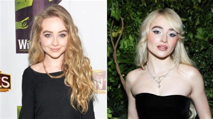 Unveiling The Truth: Does Sabrina Carpenter Have Cheek Filler?