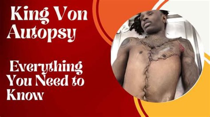 Unveiling The Truth: King Von Death Autopsy Revealed